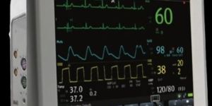 Electrocardiogram Machine