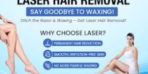 Laser Treatments