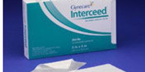 Ethicon 4350 Gynecare Interceed Absorbable Adhesion Barrier