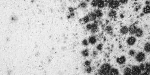 Antifungal Treatment Service