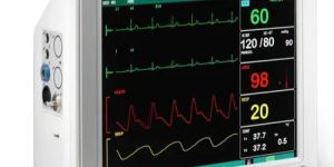 Patient Monitor