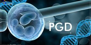 Embryo Testing (PGD, PGS)