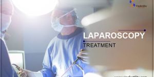 Laparoscopy Treatment