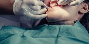 Root Canal Treatment