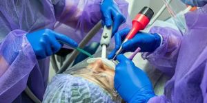 Wisdom Teeth Removal