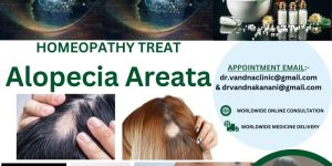 Homeopathy Skin Treatment Alopecia Areata