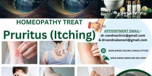 World Best Homeopathic Physicians Consultation For Skin Problem Pruritus