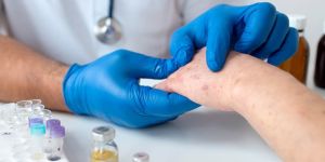 Skin Allergy Treatment Service