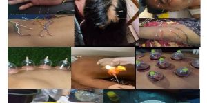 Foot Reflexology Therapy
