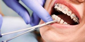 orthodontics treatment service