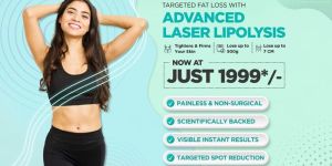 u-lipolysis treatment services