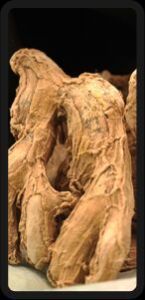Dry Ginger