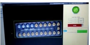 Blister Inspection System