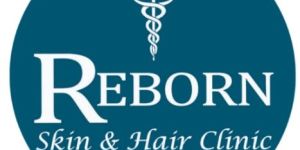 Acne Scar Treatment in Hyderabad