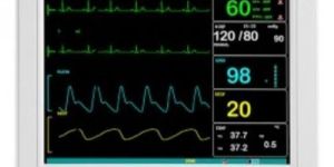 Portable Patient Bed Side Monitor