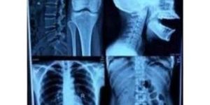 a-4 pet inkjet blue medical imaging film