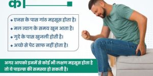 Piles Treatment Services