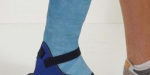 Cast Shoes
