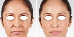 Anti Aging Treatment Services