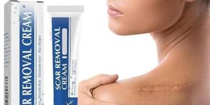 Scar Removal Cream