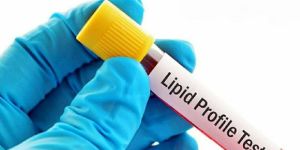 Lipid Profile Test in Delhi NCR