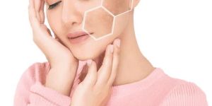 Skin Pigmentation Treatment Services