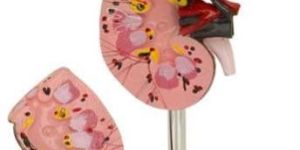 Human Kidney Model