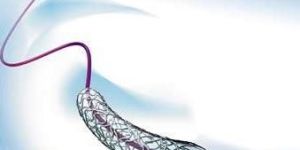 Bare Metal Tsunami Gold Stent