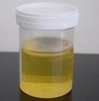 Cow Urine