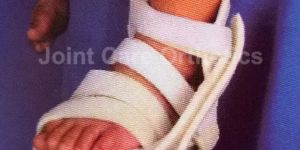 Ctev Splint