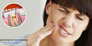 Single Sitting Root Canal Treatment