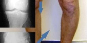 digital x-ray services