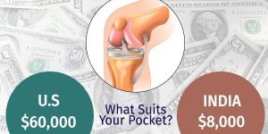 Knee Replacement Surgery