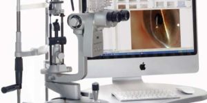 Digital Slit Lamp