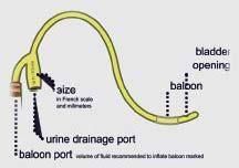 Foley Catheter