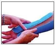 V-Lite Fiberglass Casting Tapes