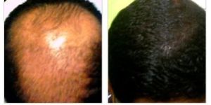 Hair Loss Clinic