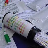Urine Test Kits