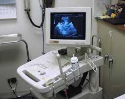 Ultrasound Machine