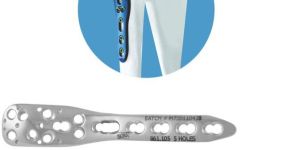 PHMA Locking Plate