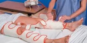 Sequential Compression Device