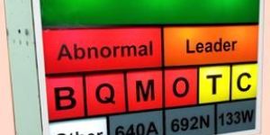 Andon Two Side Glowbox Backlit Display