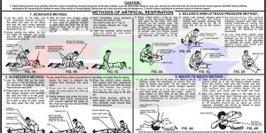Electric Shock Treatment Chart