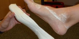 Orthotic Insoles for Flat Feet