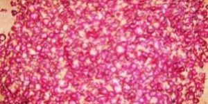 Bangalore Rose Onion