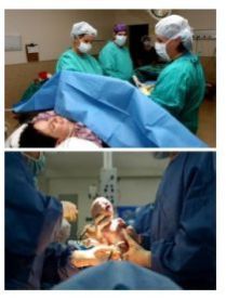 Gynecological Products