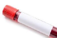 Blood Collection Vacuum Tubes