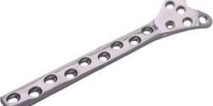 Condylar Buttress Plate