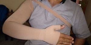 Lymphedema Arm Sleeves