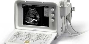 Portable Ultrasound Scanner